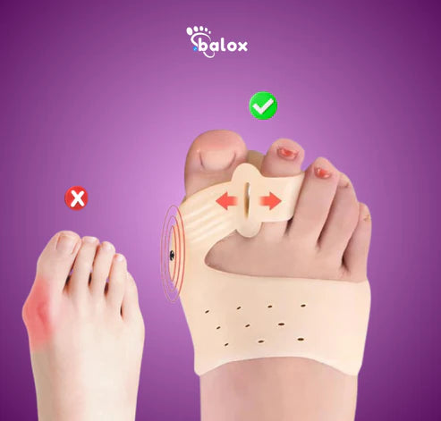 MAGNETIC BUNION PRO®